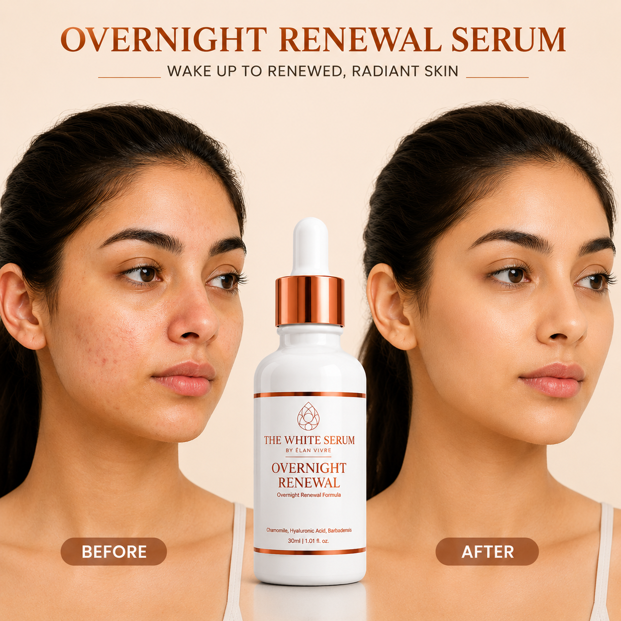 THE WHITE SERUM™ by Elan Vivre Overnight Renewal | Deep Hydration Serum for Skin Repair & Overnight Glow – 30ml